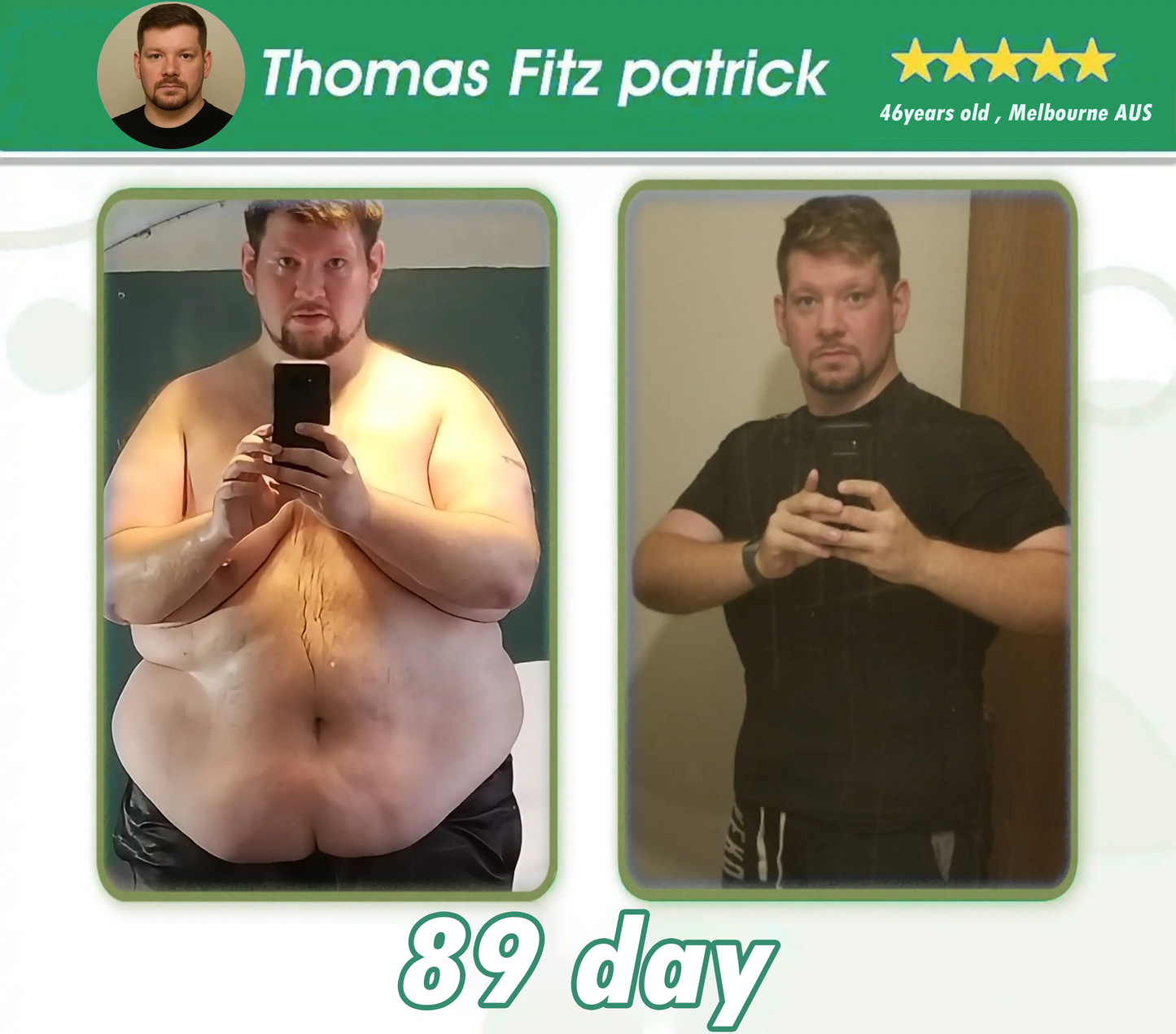 Persistence = Results! 30% HHVB discount for a limited time. Many users choose to purchase 6 boxes at a time (60 DAYS usage) as this not only stabilizes the results, but also allows them to take advantage of the awesome combo offer! ๐
