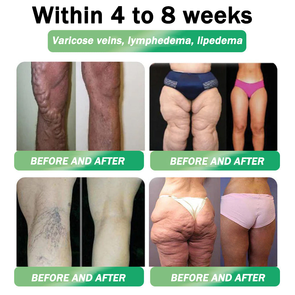 🇦🇺 𝐎𝐟𝐟𝐢𝐜𝐢𝐚𝐥 𝐒𝐭𝐨𝐫𝐞 | ☄️𝐇𝐇𝐕𝐁® 𝐍𝐀𝐃+ 𝐆𝐋𝐏-𝟏 𝐏𝐫𝐨 𝐀𝐋𝐋-𝐈𝐍-𝐎𝐍𝐄 𝐅𝐢𝐭 & 𝐕𝐢𝐭𝐚𝐥 𝐎𝐫𝐚𝐥 𝐋𝐢𝐪𝐮𝐢𝐝 (𝐉𝐮𝐬𝐭 𝐨𝐧𝐜𝐞 𝐚 𝐝𝐚𝐲, 𝐯𝐢𝐬𝐢𝐛𝐥𝐞 𝐜𝐡𝐚𝐧𝐠𝐞𝐬 𝐢𝐧 𝟕 𝐝𝐚𝐲𝐬) ✅ 𝐅𝐨𝐫 𝐨𝐛𝐞𝐬𝐢𝐭𝐲, 𝐜𝐚𝐫𝐝𝐢𝐨𝐯𝐚𝐬𝐜𝐮𝐥𝐚𝐫 𝐡𝐞𝐚𝐥𝐭𝐡, 𝐝𝐢𝐚𝐛𝐞𝐭𝐞𝐬, 𝐬𝐥𝐞𝐞𝐩 𝐚𝐩𝐧𝐞𝐚, 𝐠𝐮𝐭 𝐡𝐞𝐚𝐥𝐭𝐡, 𝐣𝐨𝐢𝐧𝐭 𝐢𝐬𝐬𝐮𝐞𝐬, 𝐚𝐧𝐝 𝐦𝐨𝐫𝐞☄️