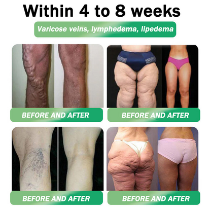 🇦🇺 𝐎𝐟𝐟𝐢𝐜𝐢𝐚𝐥 𝐒𝐭𝐨𝐫𝐞 | ☄️𝐇𝐇𝐕𝐁® 𝐍𝐀𝐃+ 𝐆𝐋𝐏-𝟏 𝐏𝐫𝐨 𝐀𝐋𝐋-𝐈𝐍-𝐎𝐍𝐄 𝐅𝐢𝐭 & 𝐕𝐢𝐭𝐚𝐥 𝐎𝐫𝐚𝐥 𝐋𝐢𝐪𝐮𝐢𝐝 (𝐉𝐮𝐬𝐭 𝐨𝐧𝐜𝐞 𝐚 𝐝𝐚𝐲, 𝐯𝐢𝐬𝐢𝐛𝐥𝐞 𝐜𝐡𝐚𝐧𝐠𝐞𝐬 𝐢𝐧 𝟕 𝐝𝐚𝐲𝐬) ✅ 𝐅𝐨𝐫 𝐨𝐛𝐞𝐬𝐢𝐭𝐲, 𝐜𝐚𝐫𝐝𝐢𝐨𝐯𝐚𝐬𝐜𝐮𝐥𝐚𝐫 𝐡𝐞𝐚𝐥𝐭𝐡, 𝐝𝐢𝐚𝐛𝐞𝐭𝐞𝐬, 𝐬𝐥𝐞𝐞𝐩 𝐚𝐩𝐧𝐞𝐚, 𝐠𝐮𝐭 𝐡𝐞𝐚𝐥𝐭𝐡, 𝐣𝐨𝐢𝐧𝐭 𝐢𝐬𝐬𝐮𝐞𝐬, 𝐚𝐧𝐝 𝐦𝐨𝐫𝐞☄️